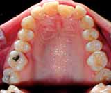 invisilign clear lake texas,invisilign webster texas,invisilign league city texas,orthodontics clear lake texas,orthodontics webster texas,orthodontics league city texas